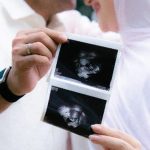Irish Bella Hamil Anak Pertama, Ungkap Rasa Haru Lewat Hasil USG
