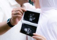 Irish Bella Hamil Anak Pertama, Ungkap Rasa Haru Lewat Hasil USG